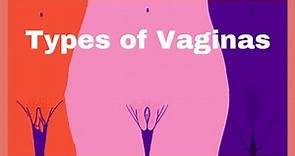 Types of Vaginas, shapes and sizes, Normal or abnormal?