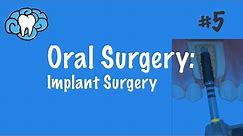 Oral Surgery | Implants | INBDE, ADAT