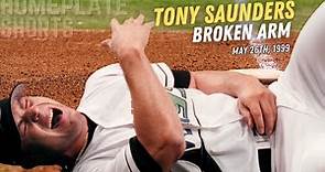The Most PAINFUL Pitch in Baseball History | The Tony Saunders Story