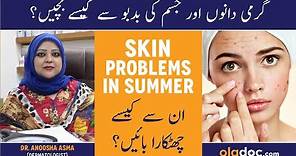 Prickly Heat & Body Odour In Summer - Garmi Men Jism Ke Dano Ka Ilaj - Summer Skin Problems In Urdu