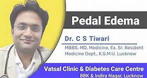 Know About Pedal Edema: Causes, Symptoms & Treatment By MD Medicine Dr. C. S. Tiwari
