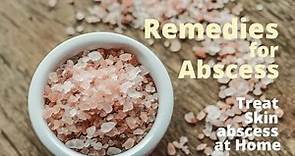 Home Remedies for Abscess - 3 Safe Ways to Treat Skin Abscess at home?
