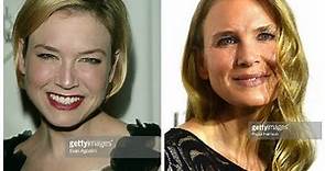 Renée Zellweger Plastic Surgery Before and After Photos