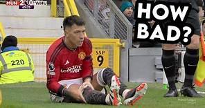Lisandro Martinez Injures His Knee vs West Ham - Doctor Explains
