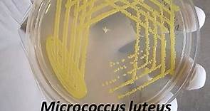 Micrococcus: Introduction, Classification, Morphology, Pathogenecity, Lab