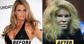 Jocelyn Wildenstein, The Golden Lion, Before and After Plastic Surgery.