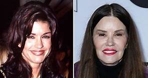 Janice Dickinson Plastic Surgery: Before, After Photos