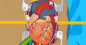 OPERATE NOW : HEART SURGERY | PLAY SURGERY GAMES