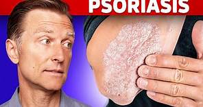 Psoriasis Treatment – The Best 3 Remedies for Psoriasis – Dr.Berg