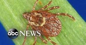 Rocky Mountain Spotted Fever Cases Could Be on the Rise