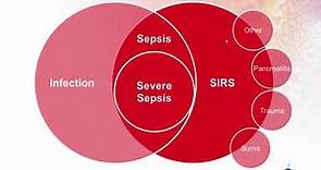 SEPSIS - Diagnosis and Management of Sepsis: The Value of Biomarkers and Rapid Microbiology | US