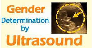 Gender Determination by Ultrasound
