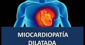 Miocardiopatía dilatada - Fisiopatología