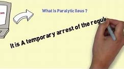 What Is Paralytic Ileus and Ways Of Ileus Treatment