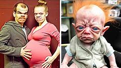 They Were Warned Not to Have Children, but They Didn't Heed - Most Unusual Births in the World