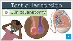 Testicular torsion: causes, symptoms, diagnosis and treatment - Clinical Anatomy | Kenhub