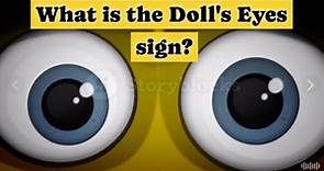 What is the Doll's eyes sign?