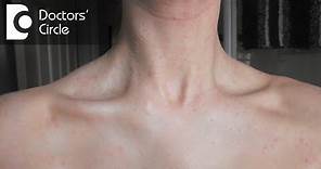 What causes a sudden red rash around the neck in women? - Dr. Aruna Prasad