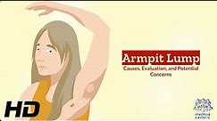 Unveiling the Mystery: Understanding Armpit Lumps