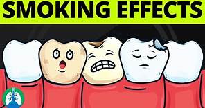What are the Effects of Smoking on Oral Health?