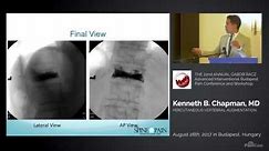 Vertebroplasty and Kyphoplasty Lecture Dr. Chapman