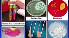 Introduction to Microbiology Culture Techniques