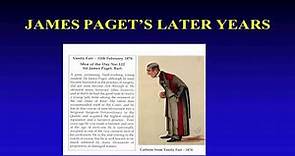 How Paget's Disease got its name and more - the Paget Family