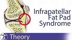 Infrapatellar Fat Pad Syndrome | Hoffa's Fat Pad