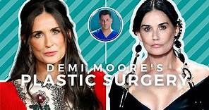 DEMI MOORE BEFORE AND AFTER: Beverly Hills Plastic Surgeon Explains What Happened