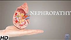 Nephropathy: Everything You Need To Know