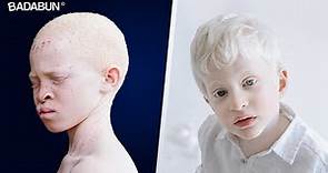 8 Datos sorprendentes de Los Albinos que no sabías