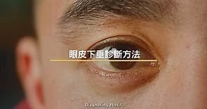 [醫生講場] 眼皮下垂的診斷及治療方法