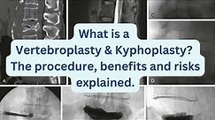 What is a Vertebroplasty & Kyphoplasty? The procedure, benefits and risks explained