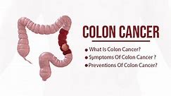 What is Colon Cancer? Symptoms & Preventions of Colon Cancer