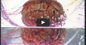 Victim of the brain [1988]