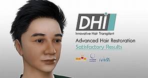 ปลูกผมถาวร เทคนิค DHI Hair Transplant โดย Dr. Danai Bangkok Hair Transplant