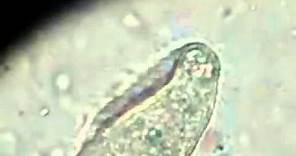 [Parasitology] Balantidium coli trophozoites - Movement in Wet Mount Preparation