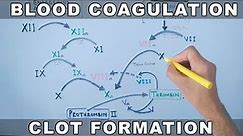 Coagulation Cascade | Intrinsic and Extrinsic Pathway