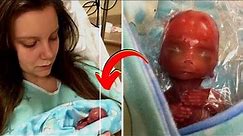 10 Most UNUSUAL Babies That Were Born Different