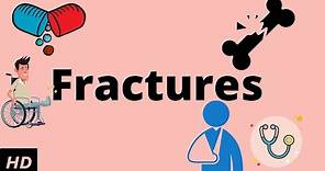 Fractures, Causes, Signs and Symptoms, Diagnosis and Treatment.