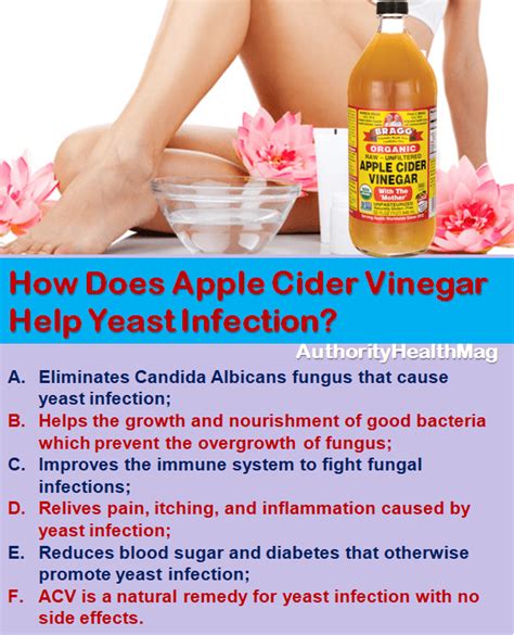 Apple Cider Vinegar for Yeast Infections