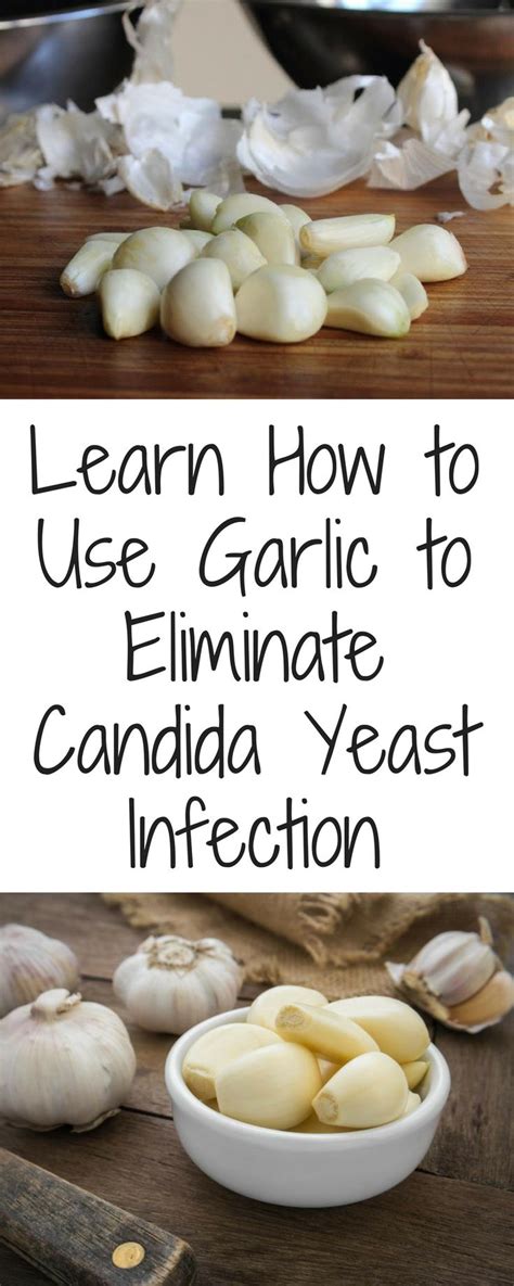 Garlic for Yeast Infections