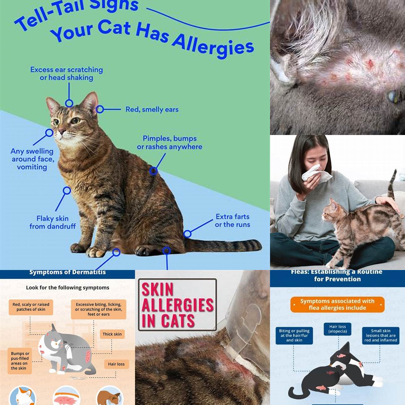4 Allergic reactions