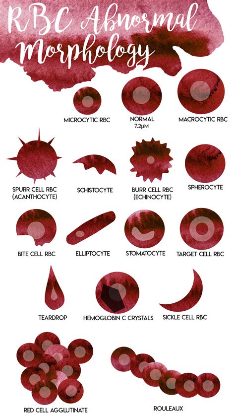Abnormal Rbc Morphology Chart