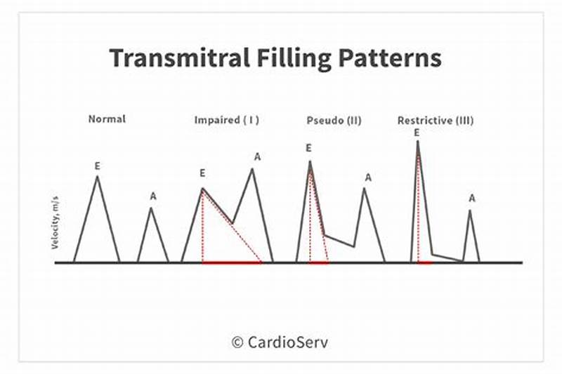 Abnormal Relaxation Pattern