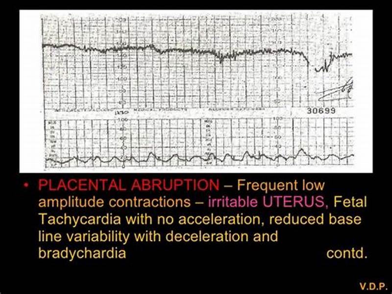 Abruption Contraction Pattern