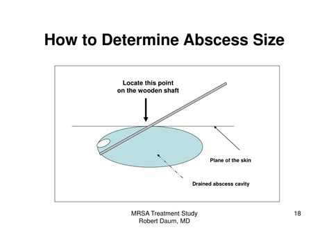 Abscess Size Chart
