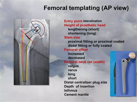Acf Templating