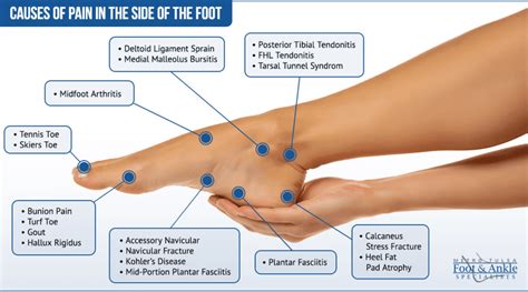 Ankle Pain Chart