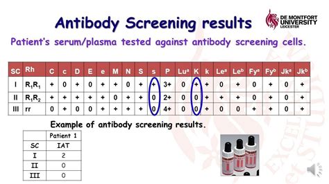 Antibody Screening Test